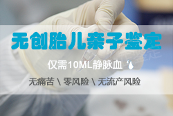 绍兴孕期亲子鉴定如何做，绍兴怀孕亲子鉴定多少钱