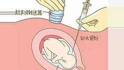 芜湖孕期亲子鉴定办理